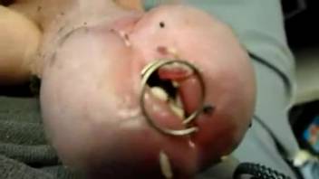 Guy's piss tube is stuffed full of tons of larvae now